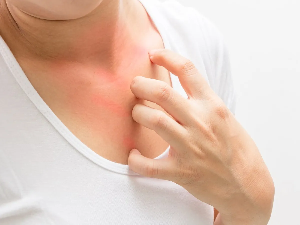 طرق علاج النخالة الوردية متوفرة (المصدر: Adobe.Stock)