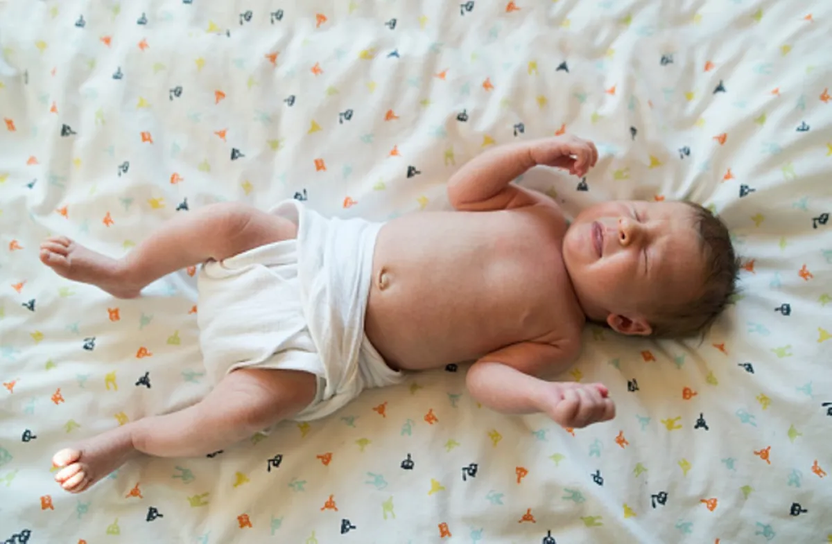 صورة لمولود سقطت سرته