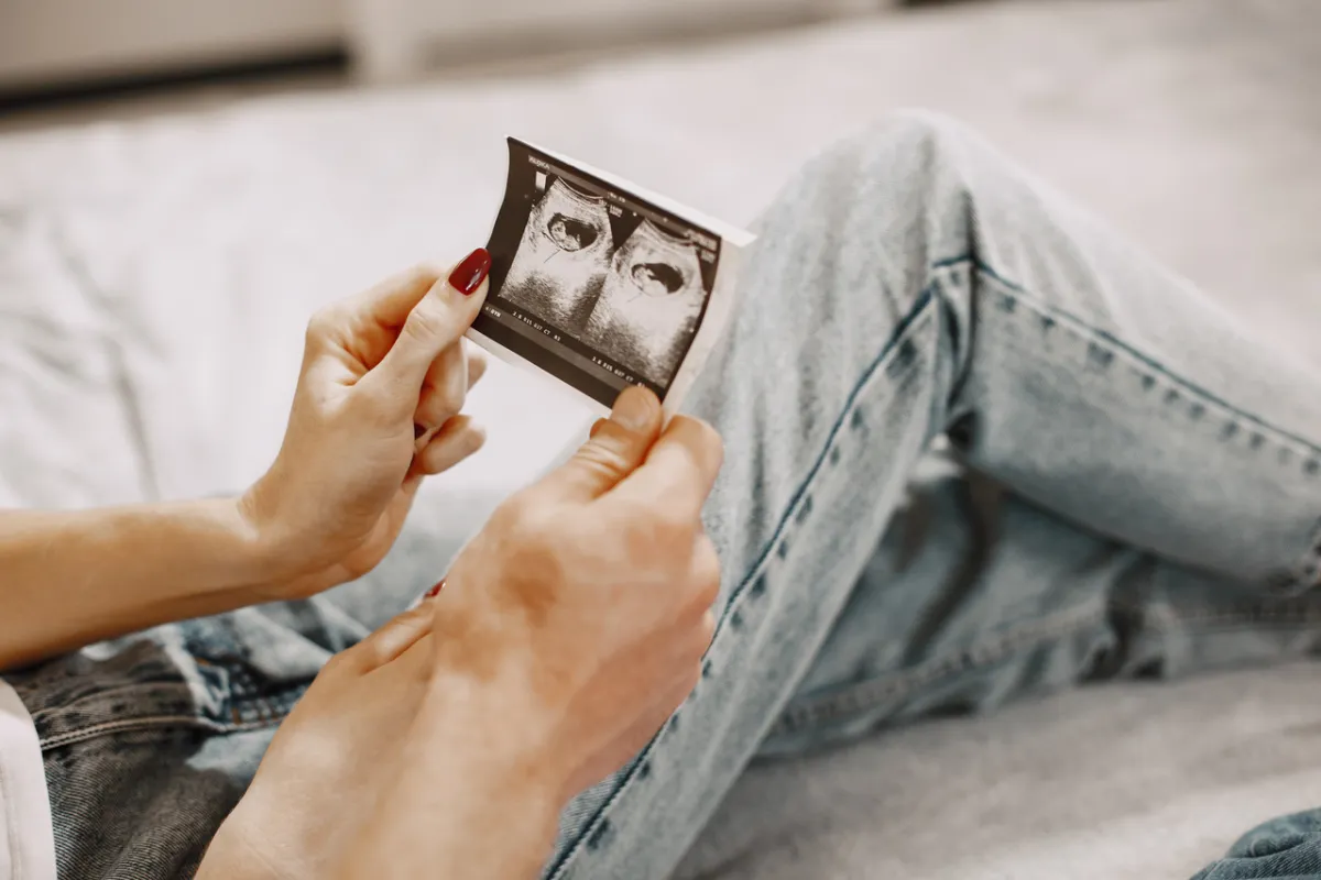 صورة لزوجين يراقبان أشعة الجنين