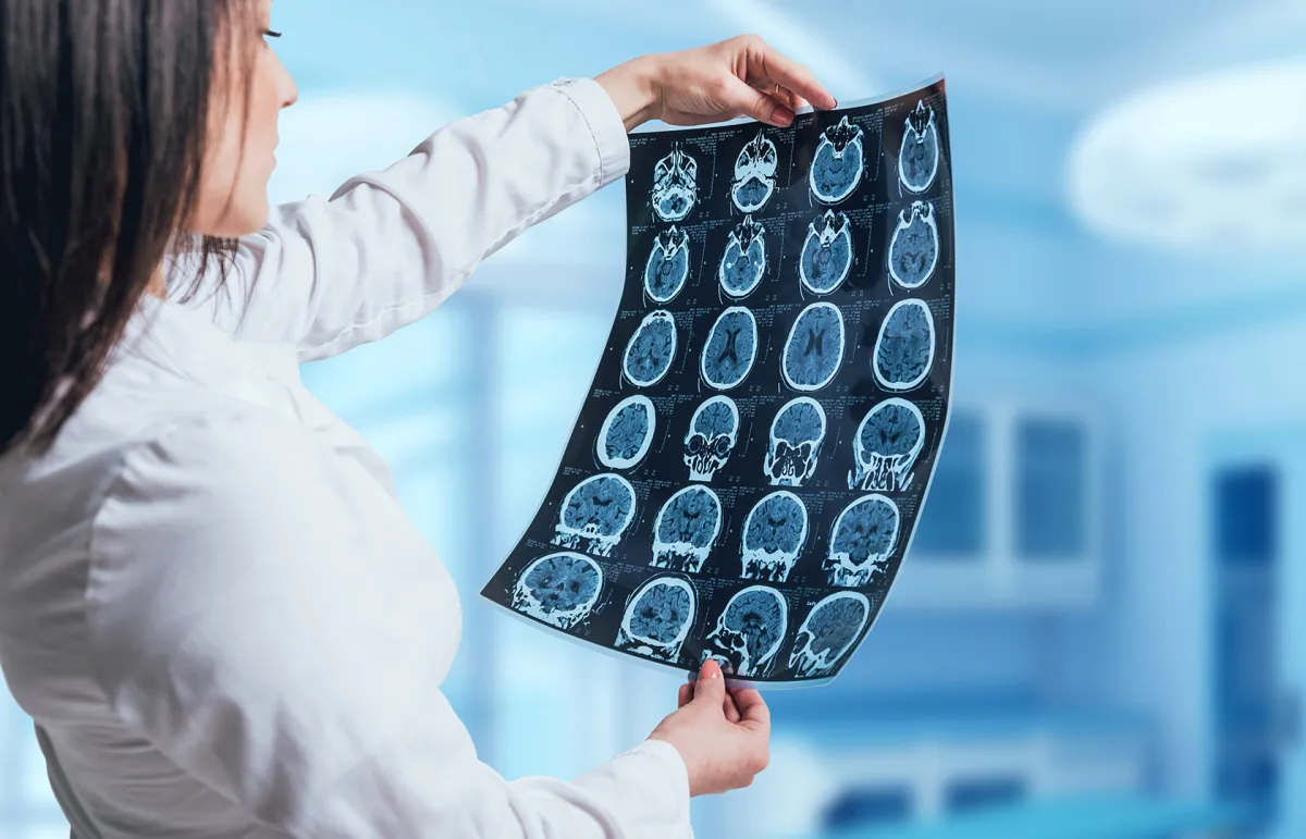 علاج خلوي مصمم لقتل ومنع سرطان الدماغ والوقاية من المرض