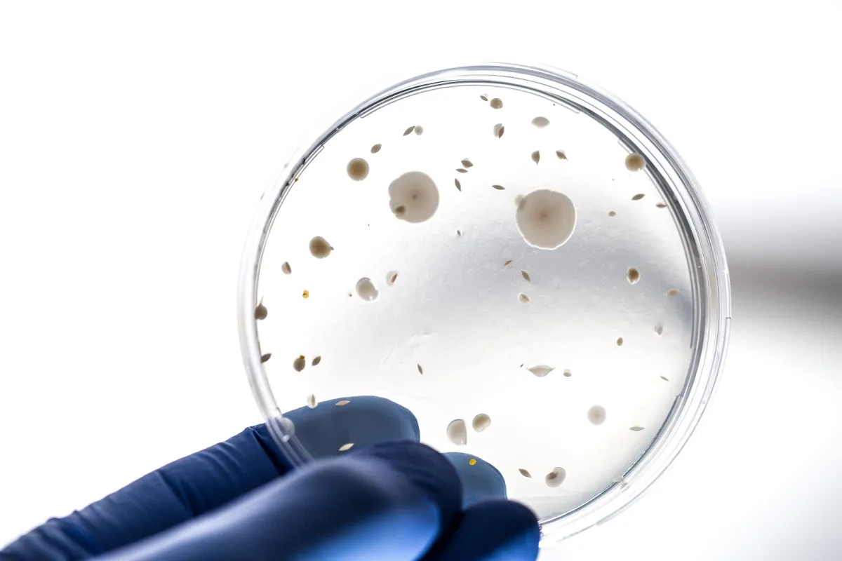   لا تؤثر الميكروبات في أمعائك على صحة الجهاز الهضمي فحسب، بل تبين أنها تلعب دوراً كبيراً جداً في صحتك العامة (المصدر: Adobe.Stock)