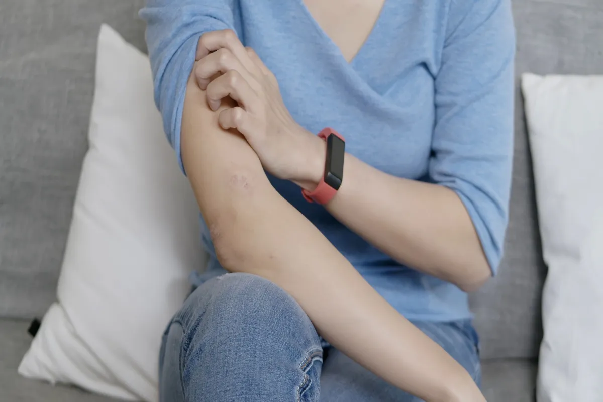 طرق علاج التينيا نهائياً.. هل هي فعّالة؟ (المصدر: Adobe.Stock)