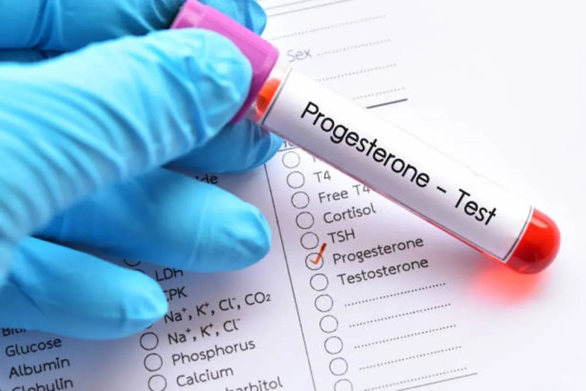 صورة تشير لهرمون البروجيسترون وهو من هرمونات الحمل