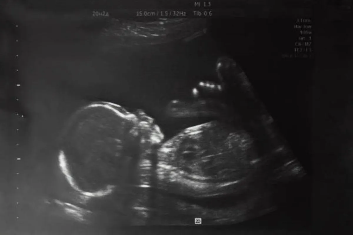 صورة لجنين في أسابيعه الأولى