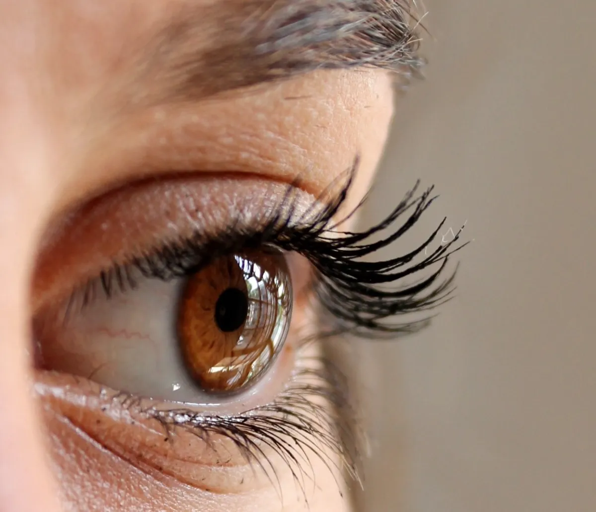 صورة لأوردة العين