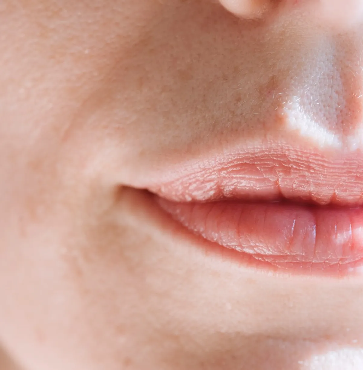 صورة لبشرة دهنية