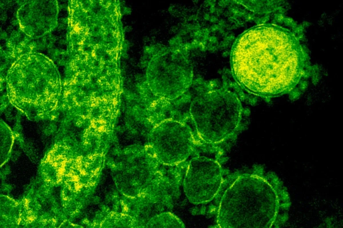 فايروس قاتل- المصدر Pexels