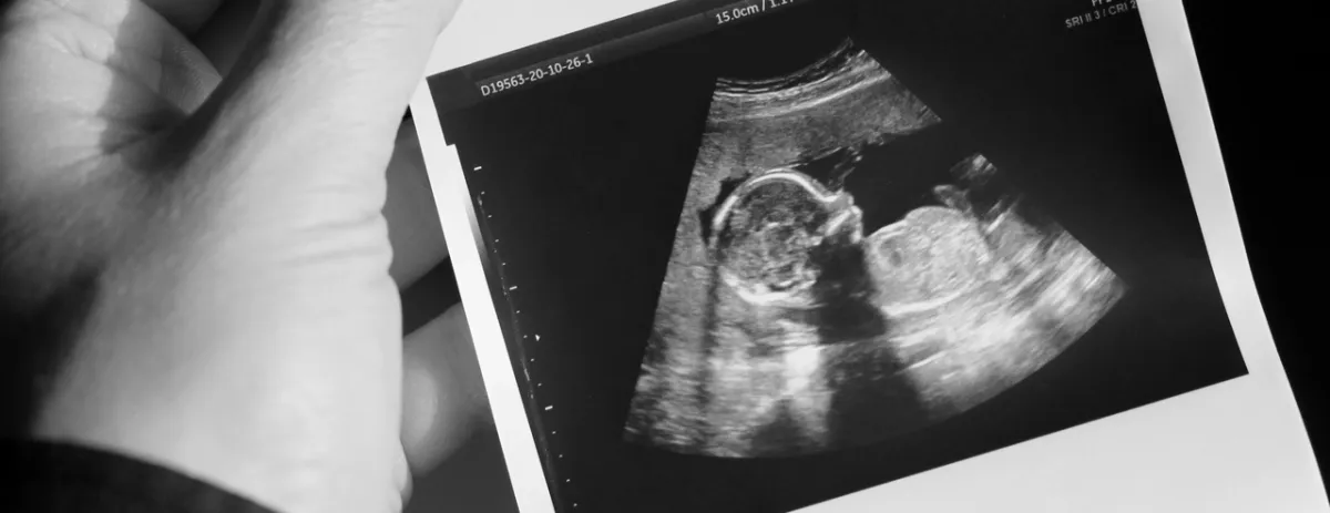 صورة لمكان جلوس الجنين