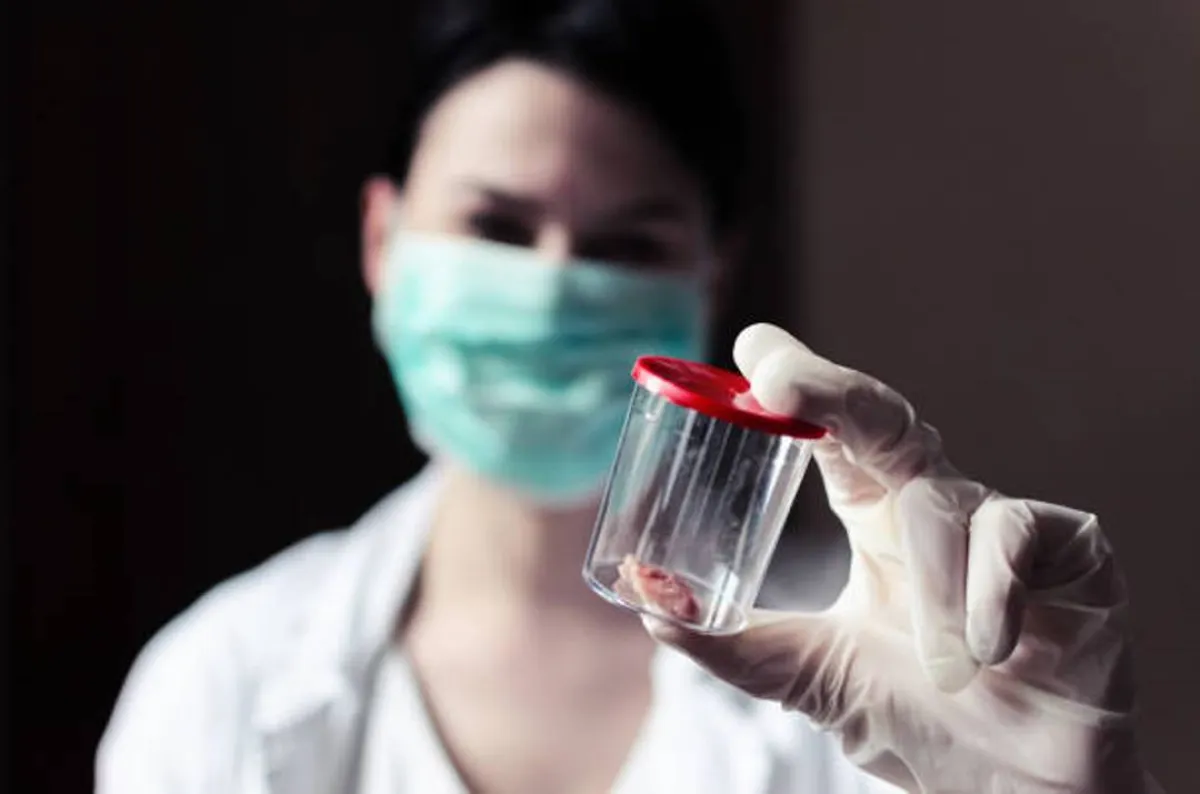 صورة تشير لاستئصال زوائد من الرحم بالمنظار