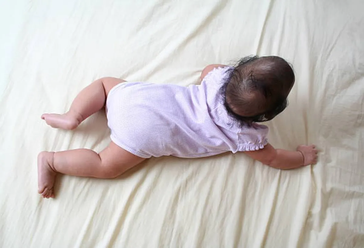 صورة لرضيع لديه مشكلة في مؤخرة الرأس