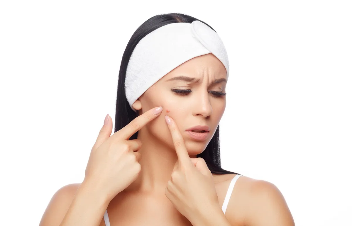 علاج حب الشباب بالثوم.. هل يفيد حقاً؟