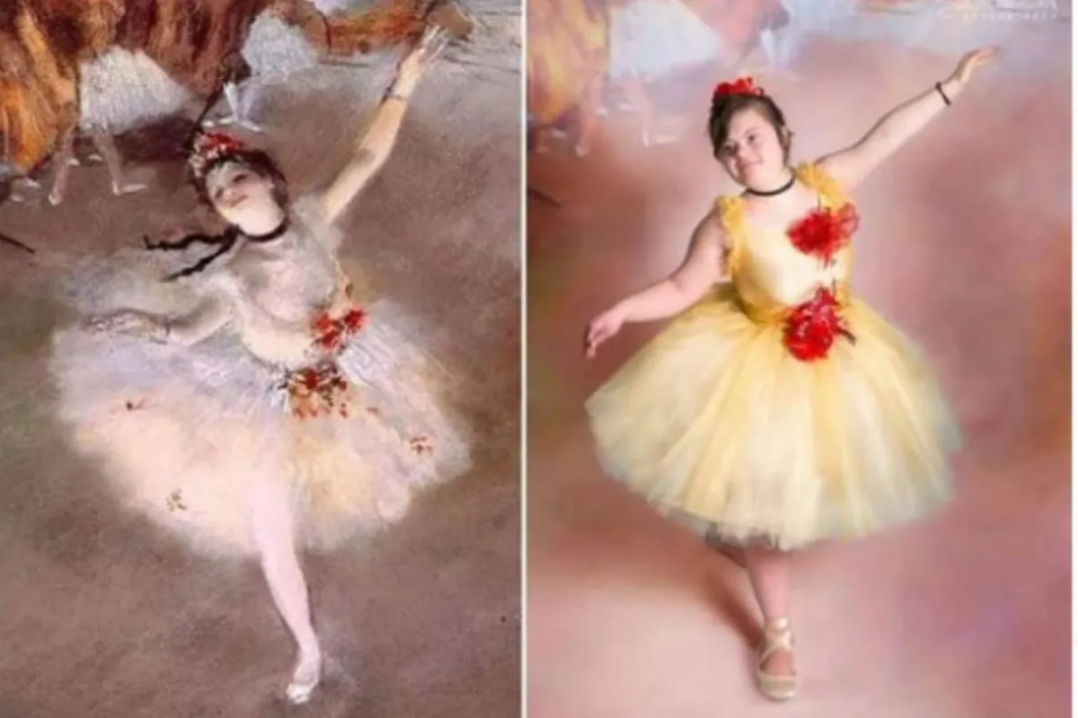 أطفال من متلازمة داون في لوحات عالمية 