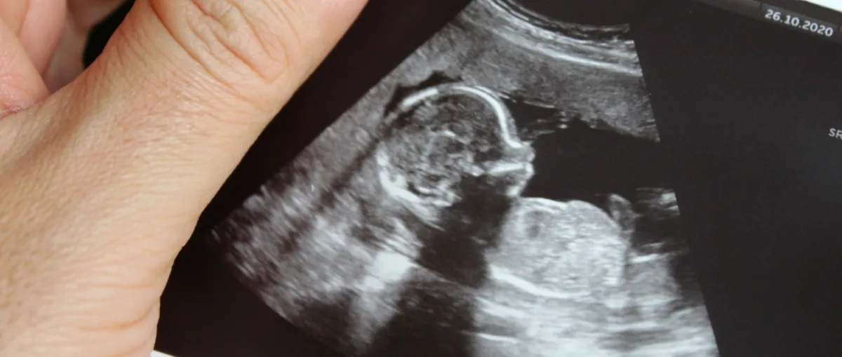 صورة للجنين