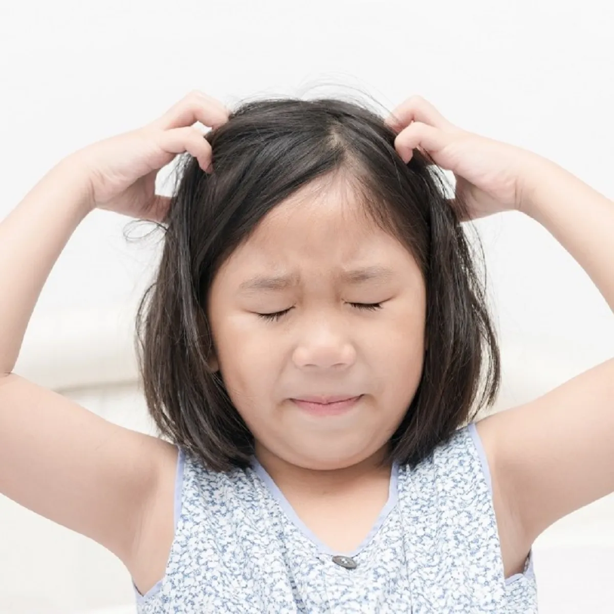 صورة لطفلة تعاني من الطفح الجلدي