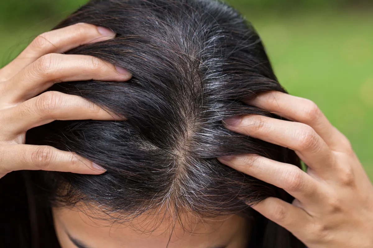 فوائد الشمندر للشعر الأبيض