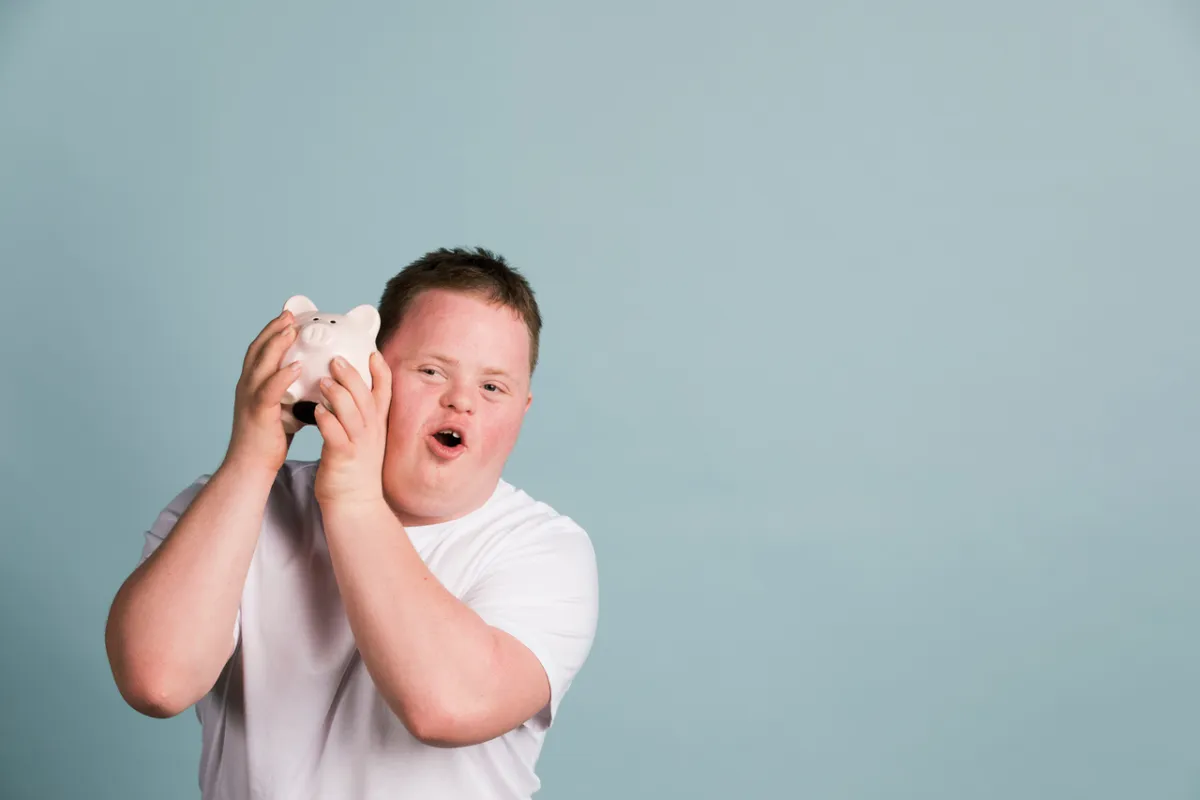 صورة طفل مصاب بمتلازمة داون