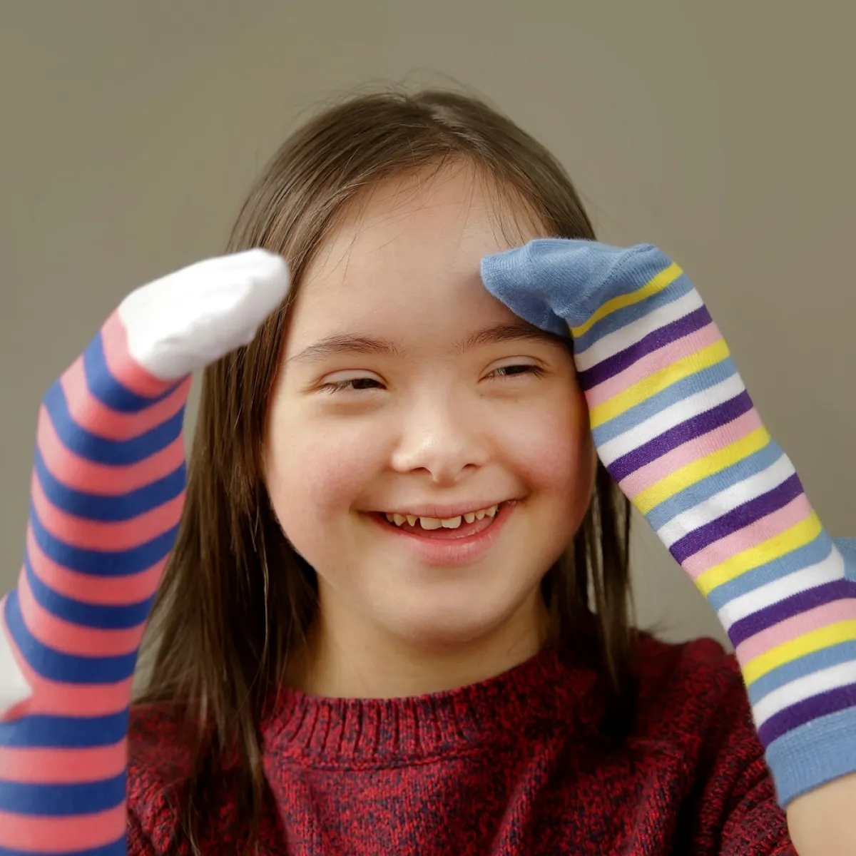 صورة لطفلة مصابة بمتلازمة داون