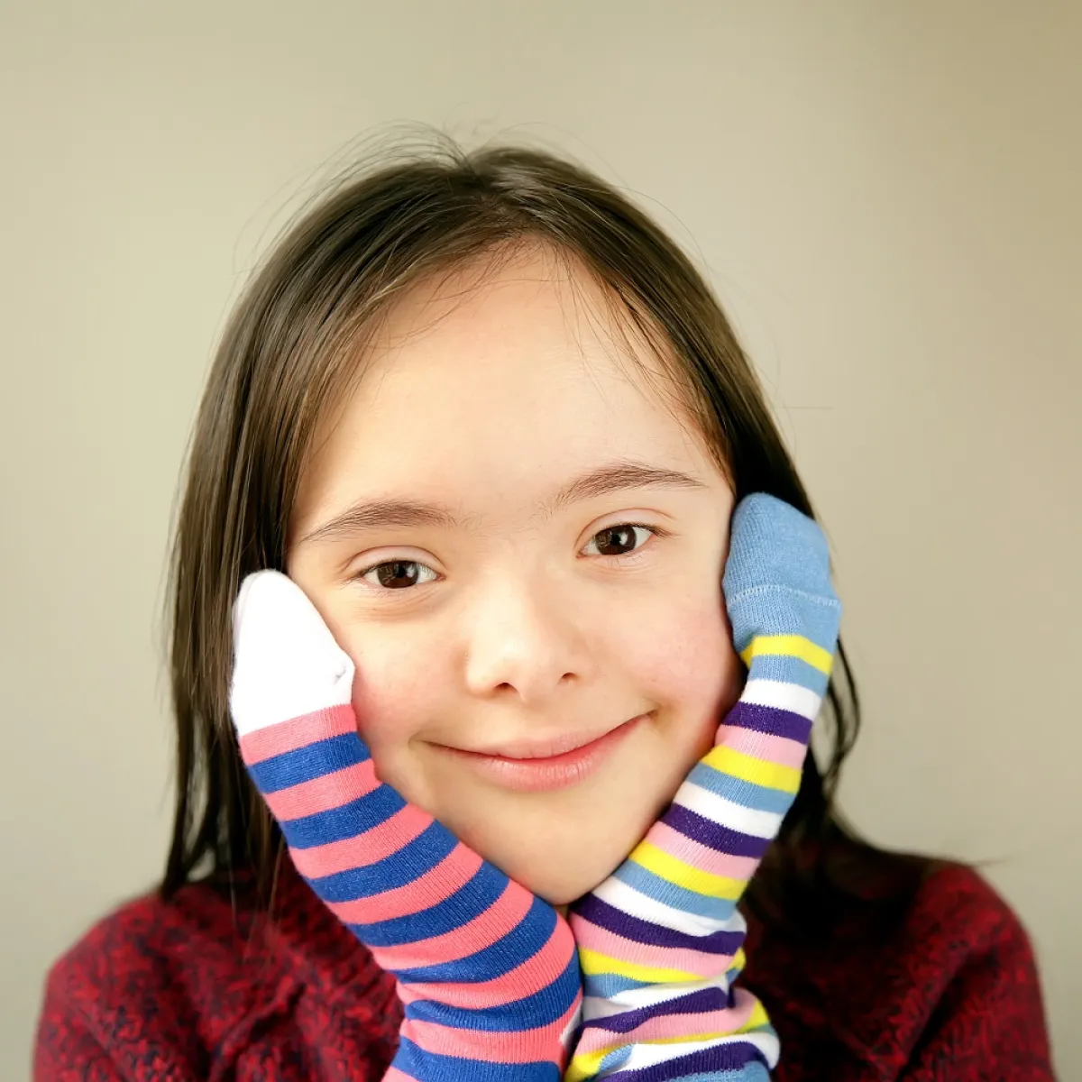 صورة لطفلة مصابة بمتلازمة داون