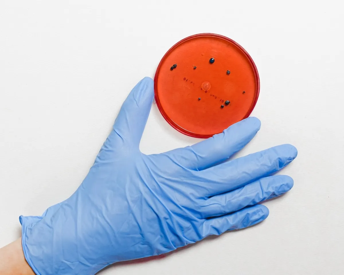 فيروس ماربورغ (المصدر: pexels )