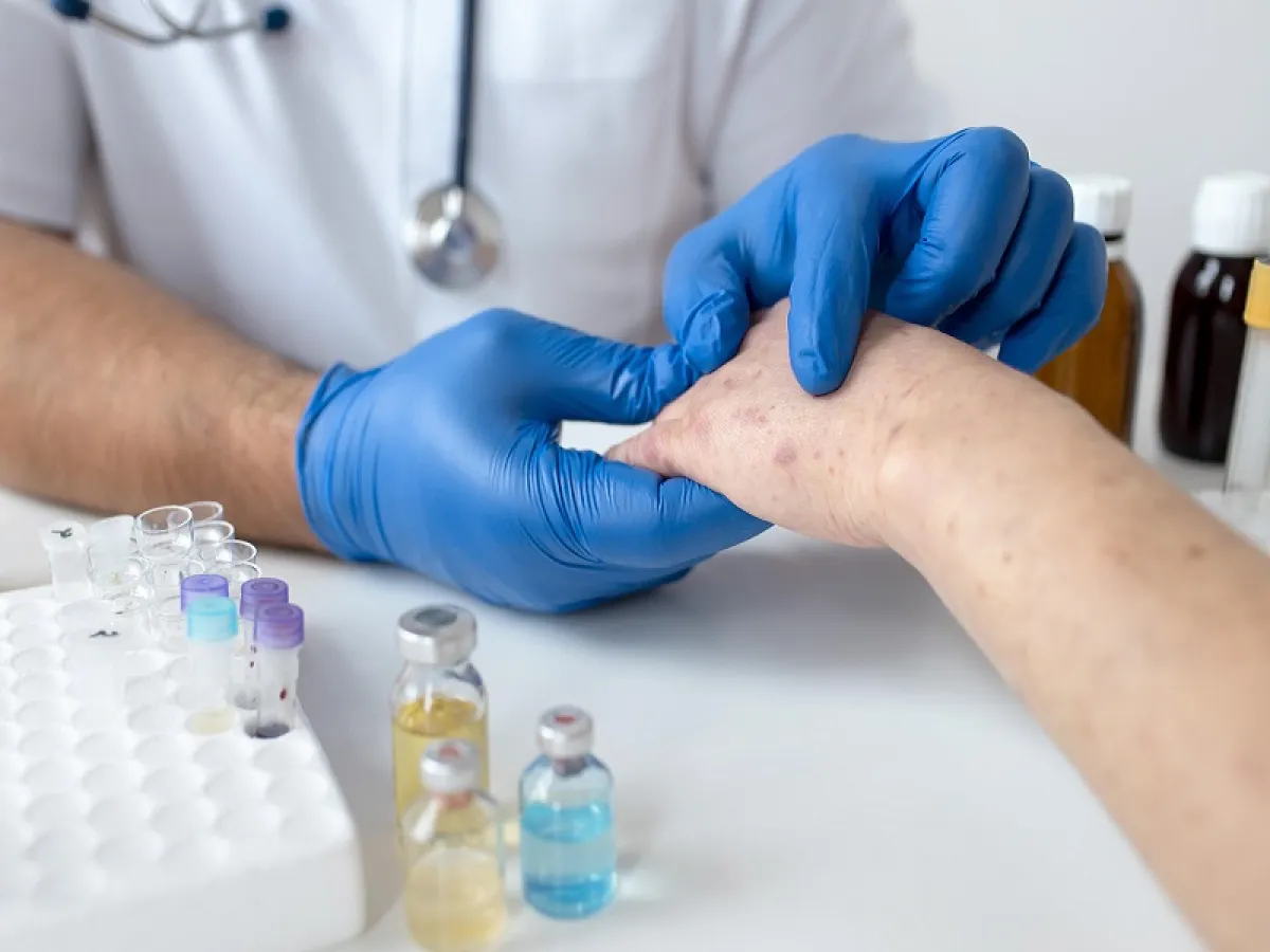 يحتاج الخراج إلى العناية الطبية إذا زاد حجمة أو تسبب في الحمى (المصدر: Freepik)