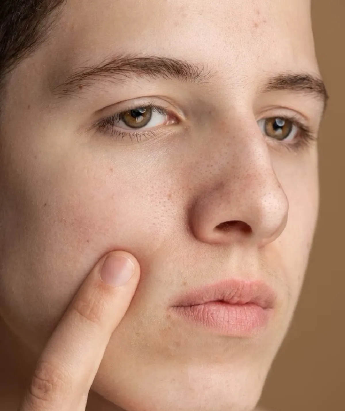 البشرة الجافة