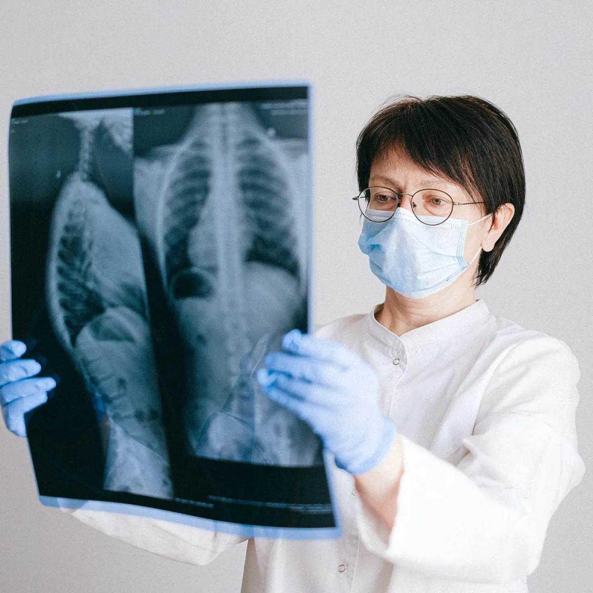 التهاب الشعب الهوائية (المصدر: pexels)