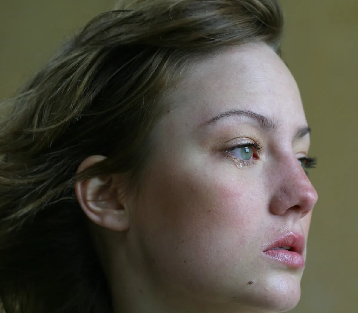 الذئبة الحمراء مرض مناعي (المصدر: Pexels )