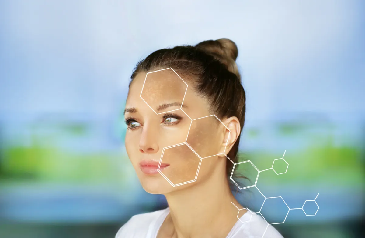 صورة لتبقع الوجه