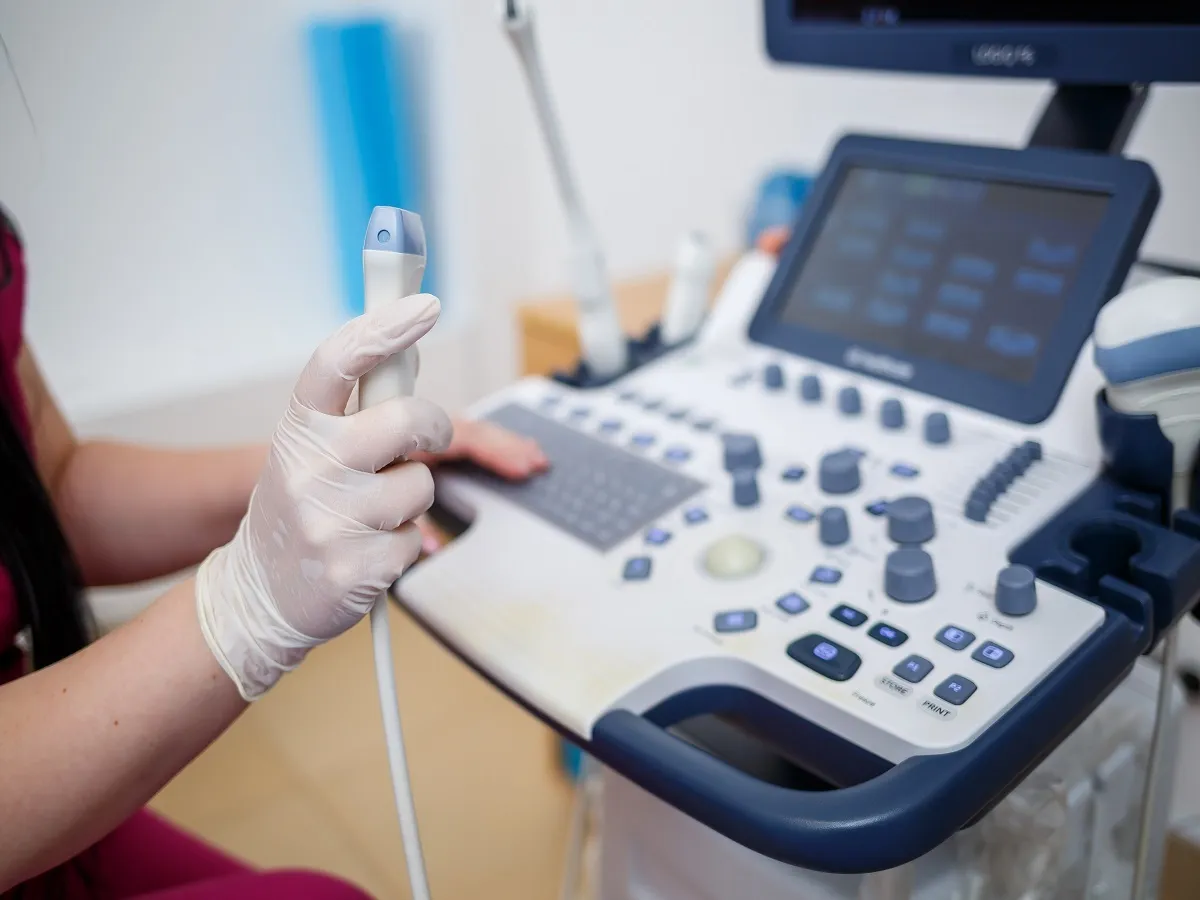 صورة لجهاز السونار