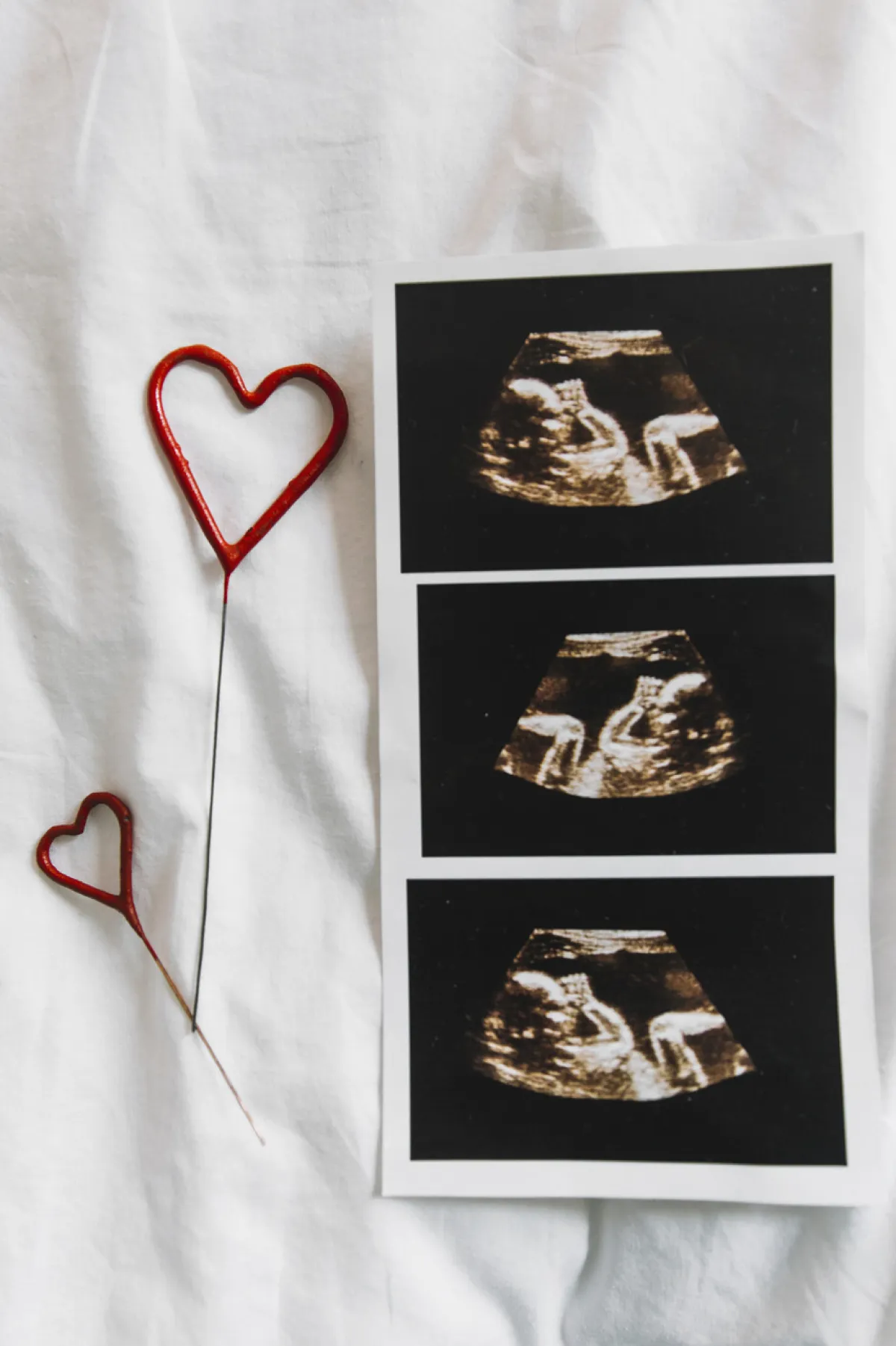 صورة تعبيرية عن نبض الجنين