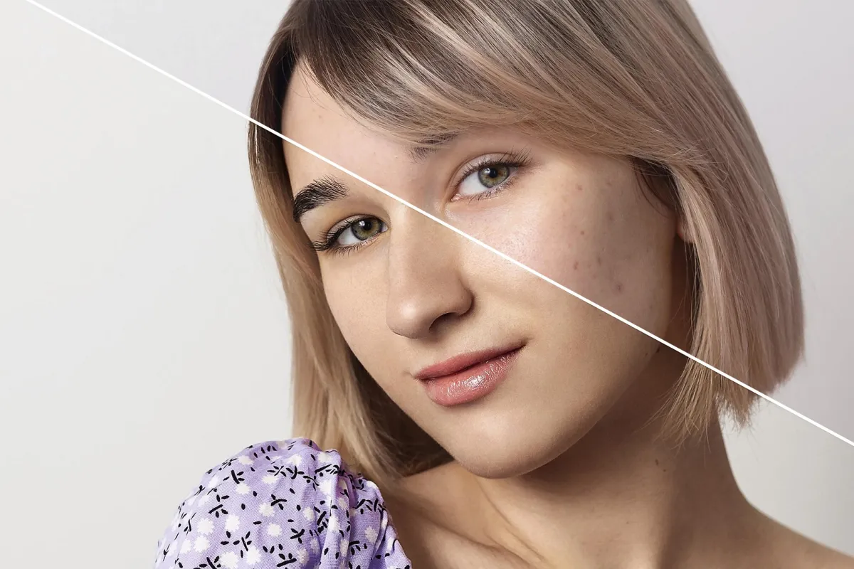 مع ومن دون كولاجين