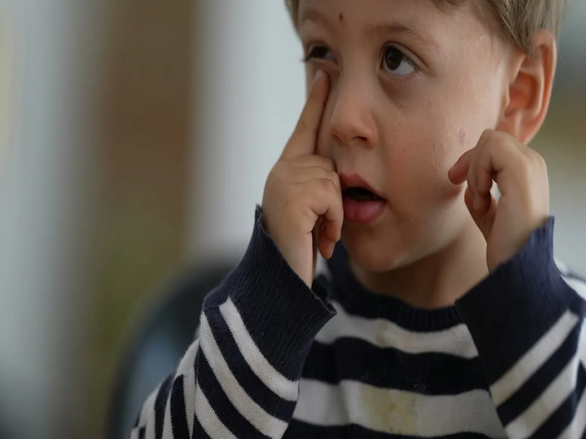 صورة لطفل يعاني من اعتام عدسة العين