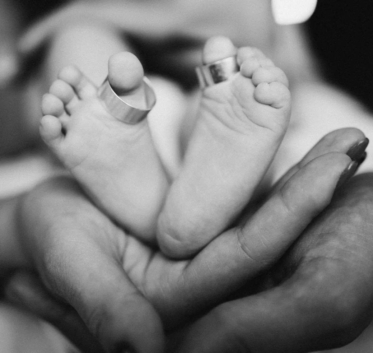 صورة تعبيرية عن الشبه