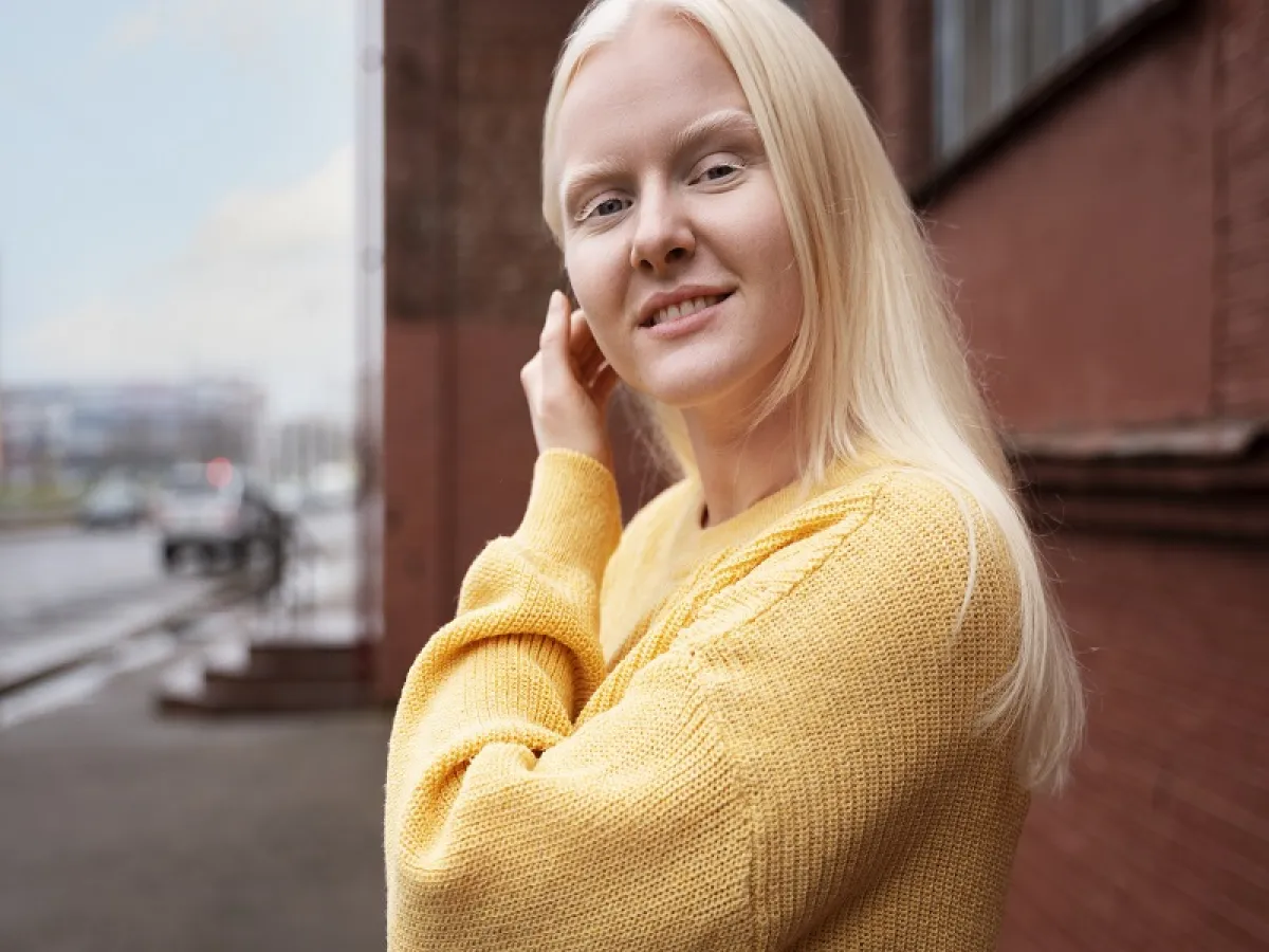 بدأ الاحتفال باليوم العالمي للتوعية بالمهق في 2015 للتوعية بالمرض(المصدر: Freepik)