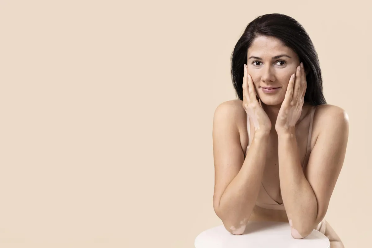 عندما يتم تدمير الخلايا الصباغية تظهر خلايا الجلد بيضاء مما يسبب البهاق (المصدر: Freepik)