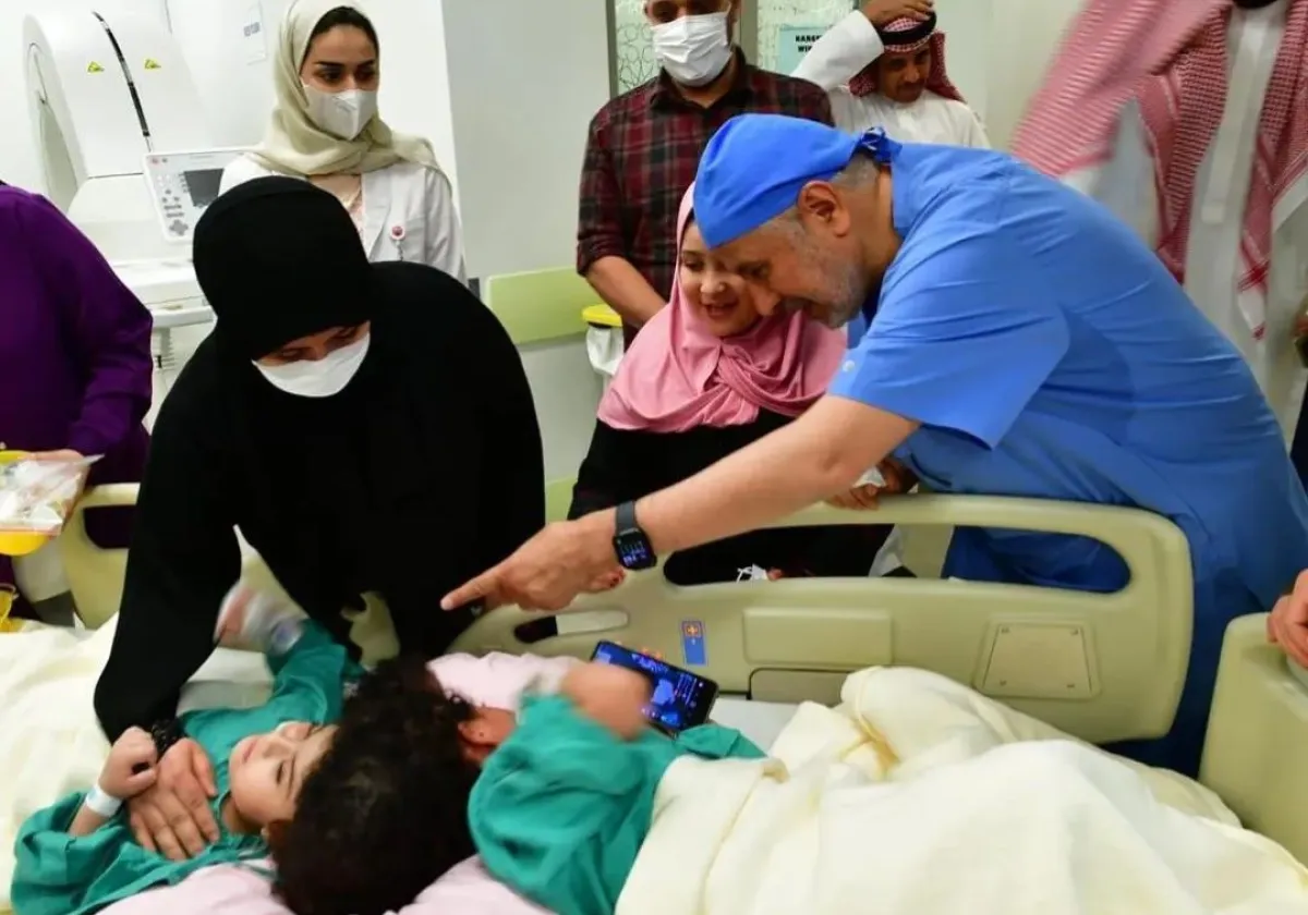 التوأم السيامي