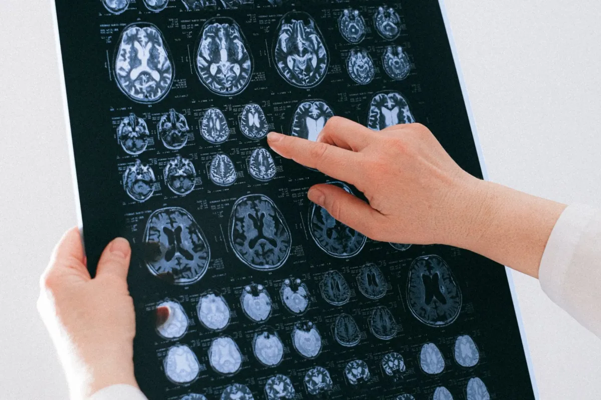 دراسة تقارن بين متحدثي العربية والألمانية في تشكيل الدوائر العصبية للمخ