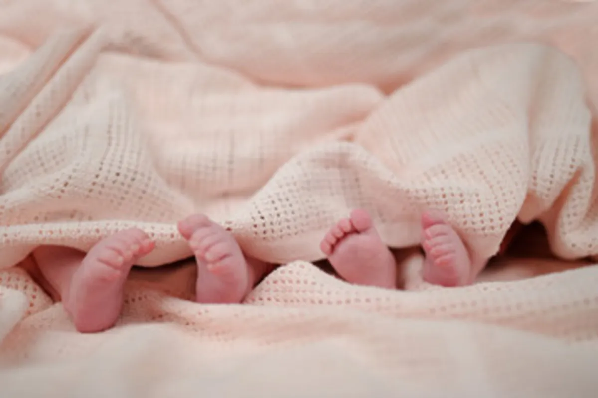 صورة لتوائم على قيد الحياة