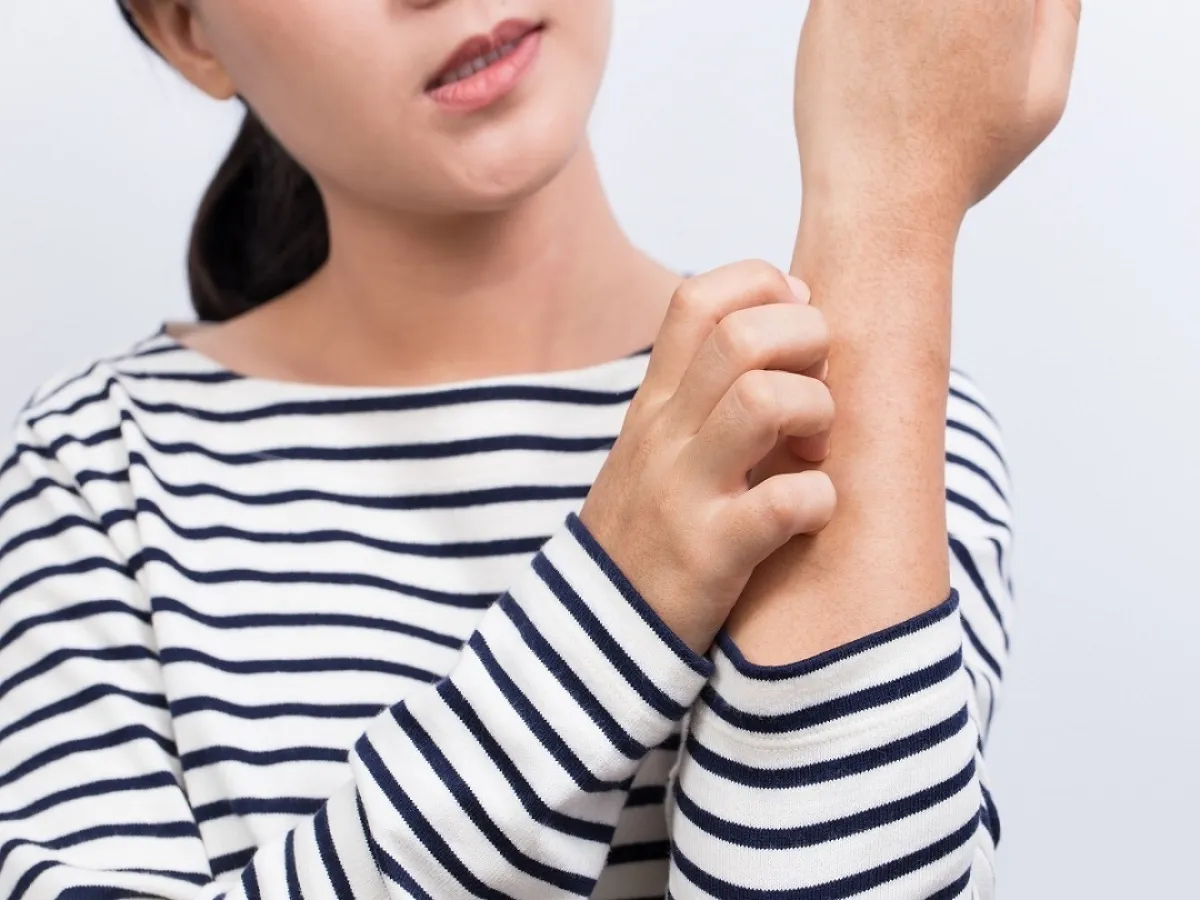 صورة لامرأة تشعر بالحكة