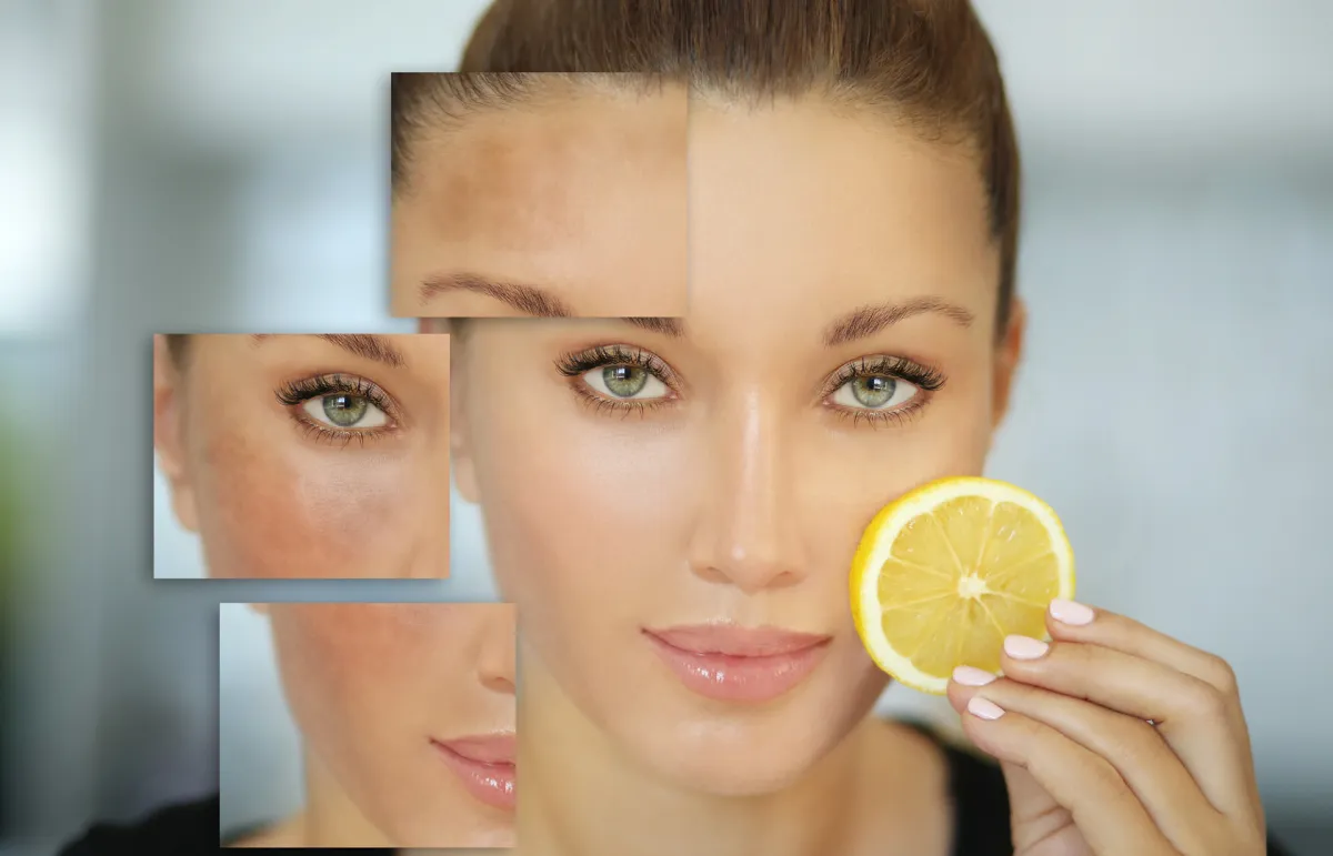أفضل خلطات طبيعية لتبييض الوجه