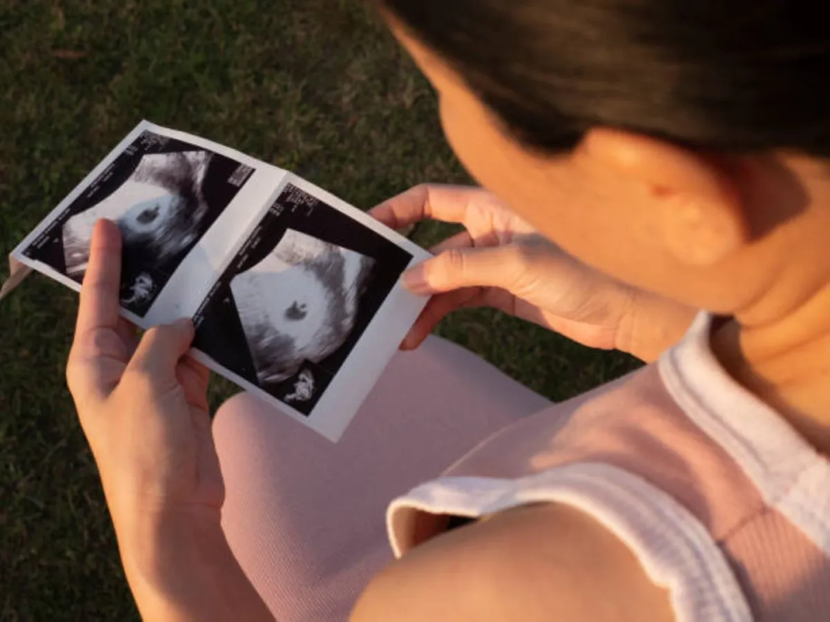 صورة لأم تتابع حملها والاستعداد للولادة