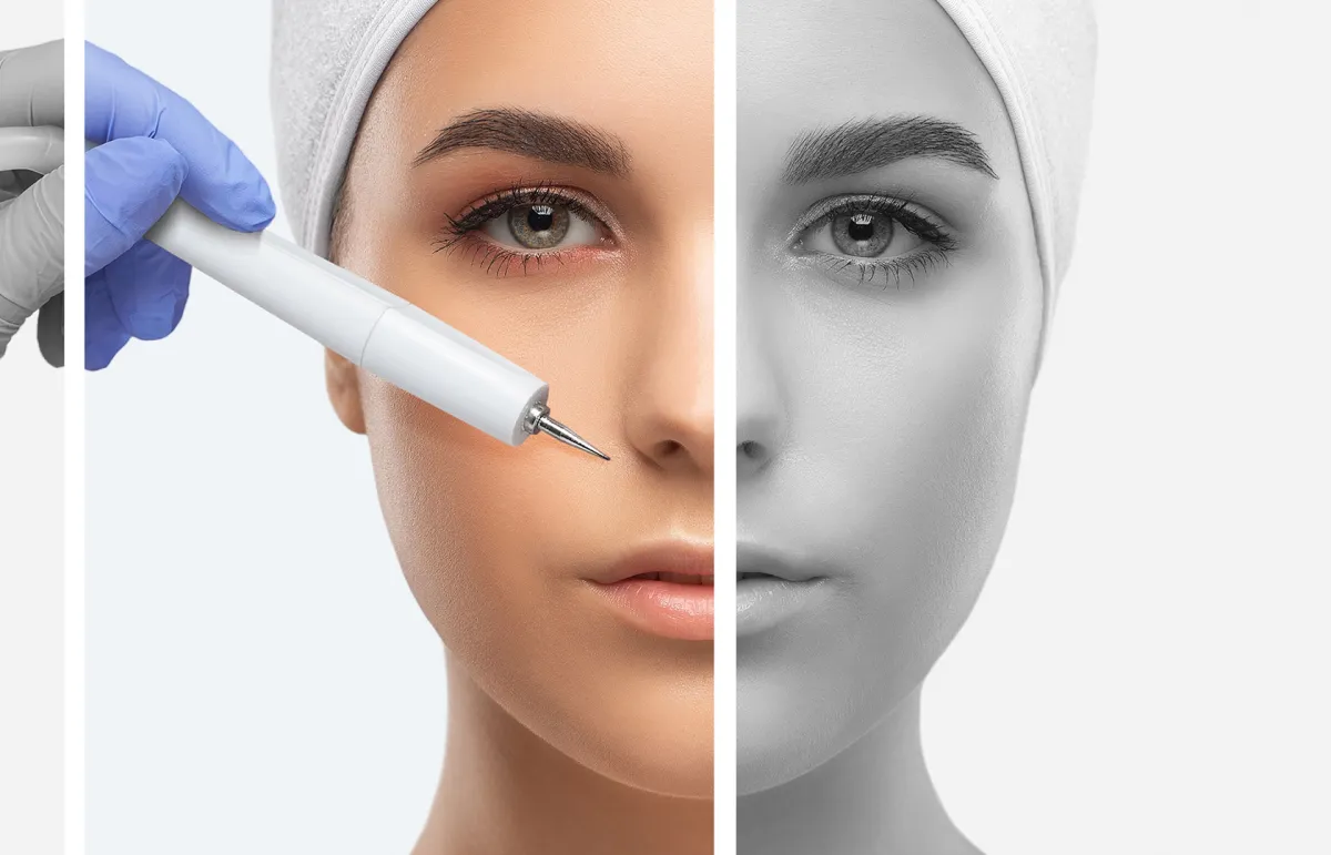 إجراءات طبية لعلاج الندبات القديمة Scars Treatments