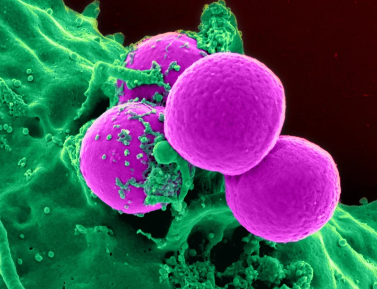 اكتشاف علمي جديد قد يمنع تكوّن بعض الأورام العنيفة (المصدر: Pexels)