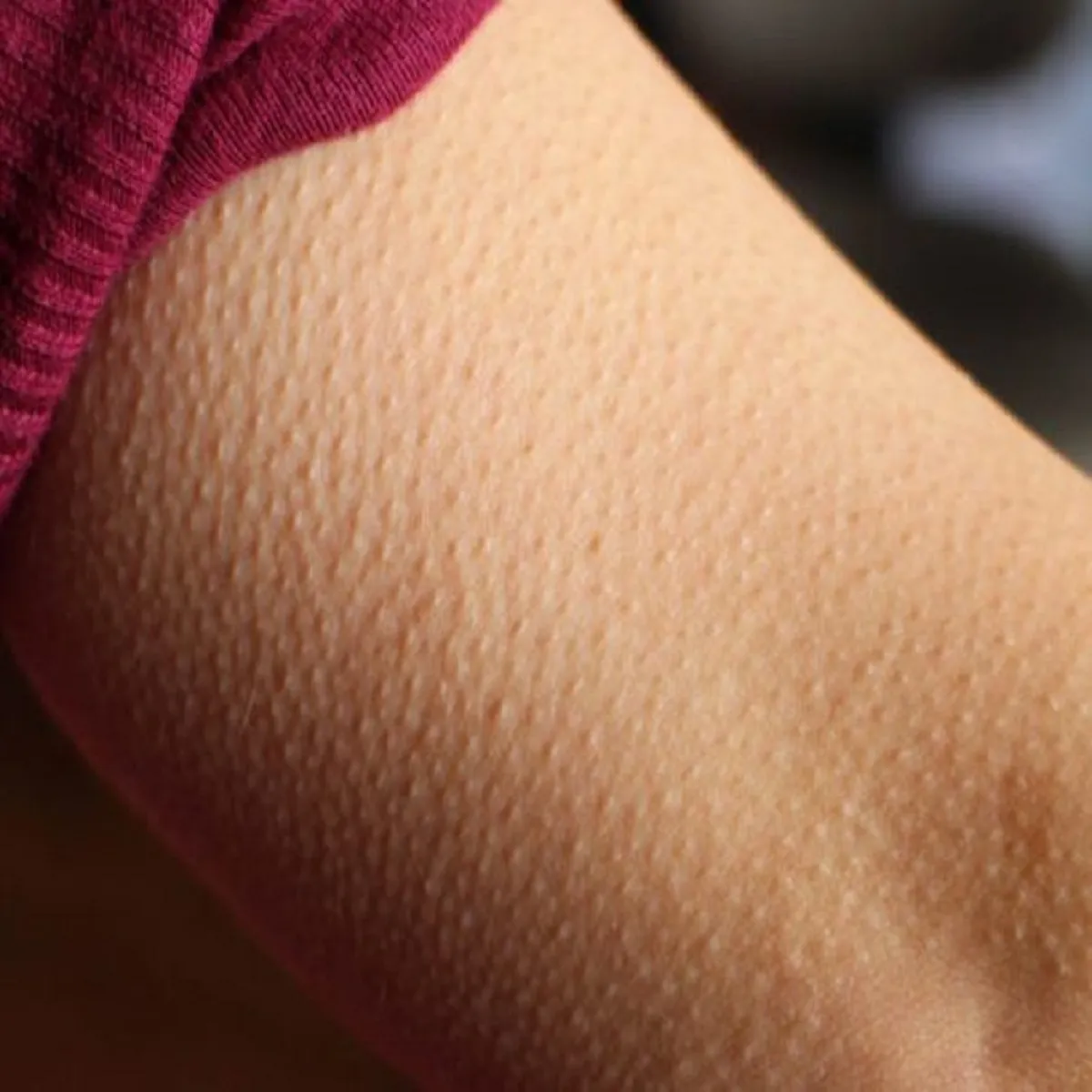 القشعريرة المفاجئة (المصدر: pixabay)