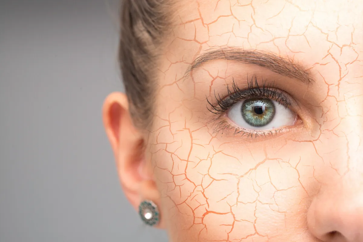 صورة تعبيرية عن الجفاف