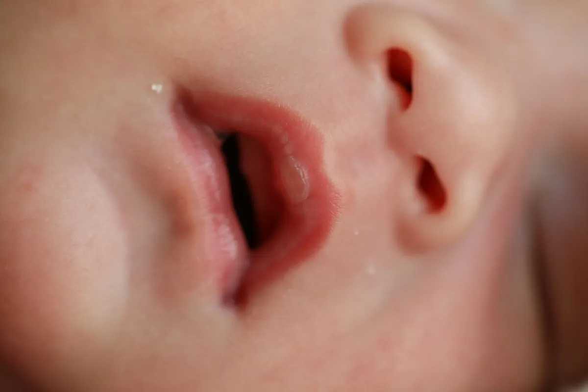 صورة لتنفس الرضيع من الفم