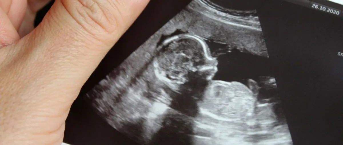 صورة للجنين في رحم الأم