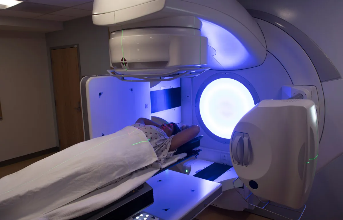 الآثار الجانبية للعلاج الإشعاعي لسرطان الثدي (المصدر: Shutterstock)