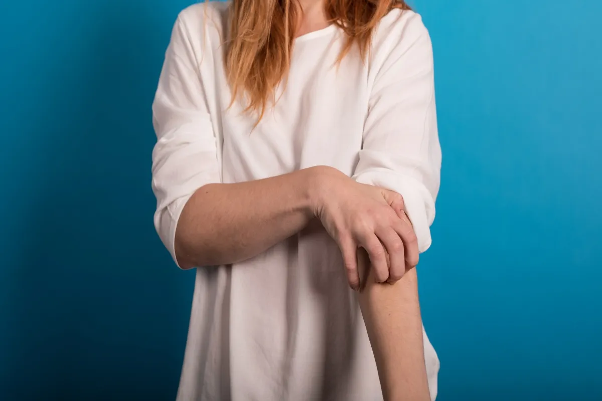 الاعتماد على التغذية وفقدان الوزن والميكروبيوم من الطرق الجديدة لعلاج الصدفية (المصدر: Adobe.Stock)