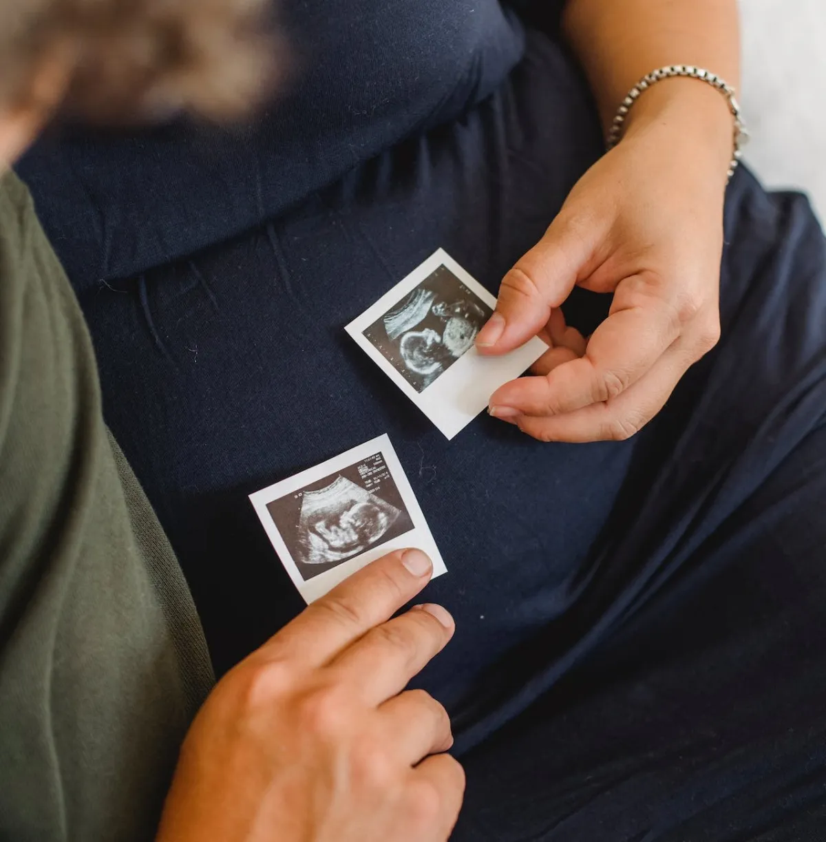 صورة لعملقة الجنين